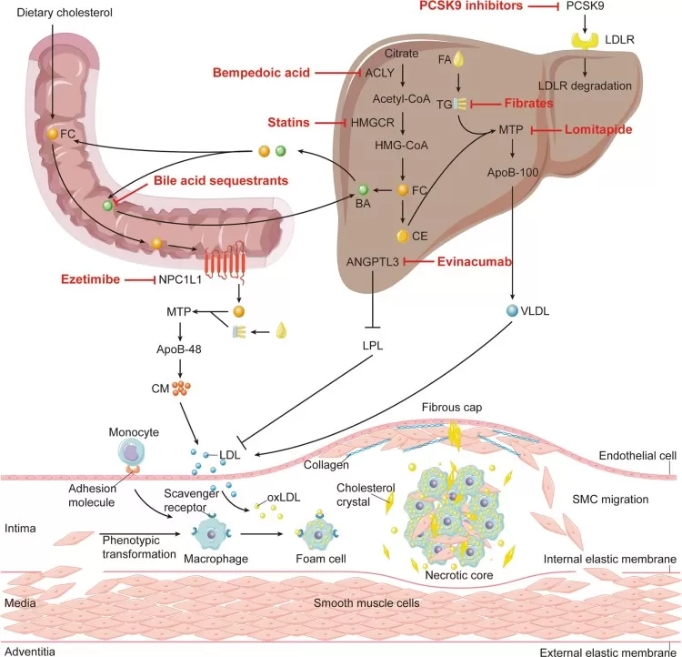 Inhibition of atherosclerosis by cholesterol-lowering interventions showing plaque regression mechanisms